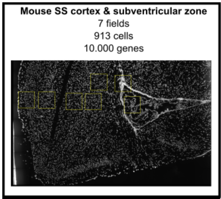 _images/mouse_SS_cortex_and_subventricular.png