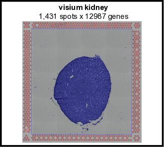 _images/visium_kidney_image_summary.png